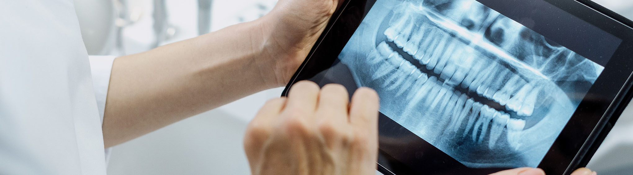 Person holding dental model